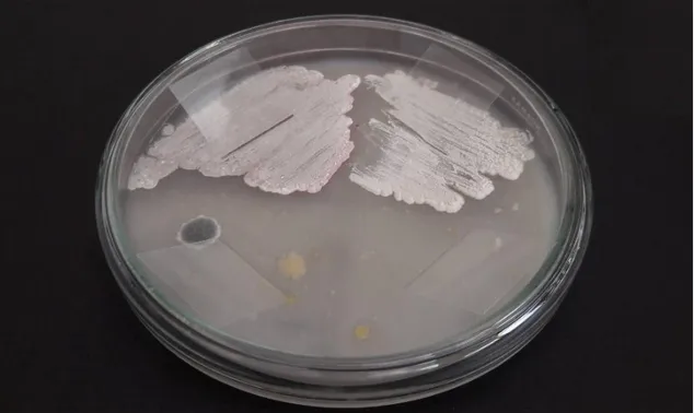 Figura 9.   Colonias de Actinobacterias con micelo aéreo no pigmentado. 