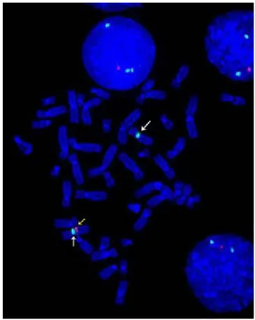 Figura 4. Hibridación in situ fluorescente del caso 2.