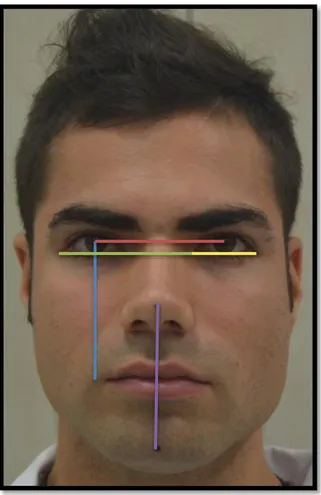 Gráfico 4. Representación de las medidas analizadas.  MFA  COLOR  Distancia horizontal  entre pupilas  ROJO  Distancia entre el  canto externo de  un ojo al canto  interno del otro 
