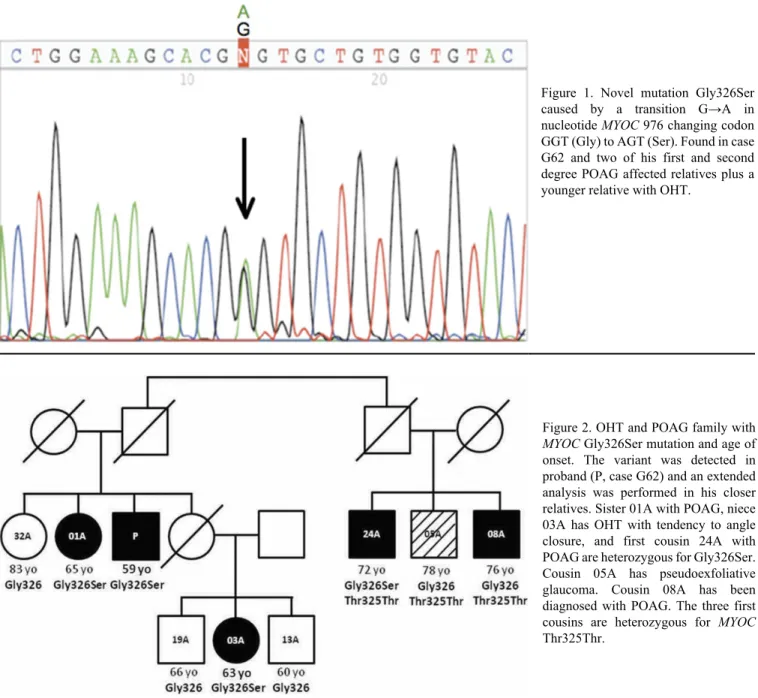 Figure  1.  Novel  mutation  Gly326Ser caused  by  a  transition  G→A  in nucleotide MYOC 976 changing codon GGT (Gly) to AGT (Ser)