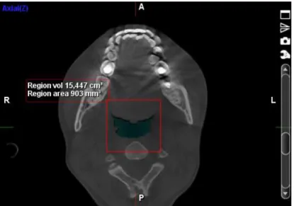 Figura 10. Corte axial. 