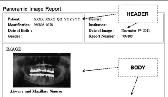 Fig. 3. Deployment of the dental panoramic CDA.