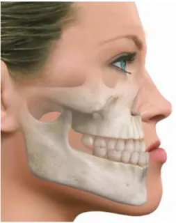 Fig 2. Discrepancia sagital de maxilares