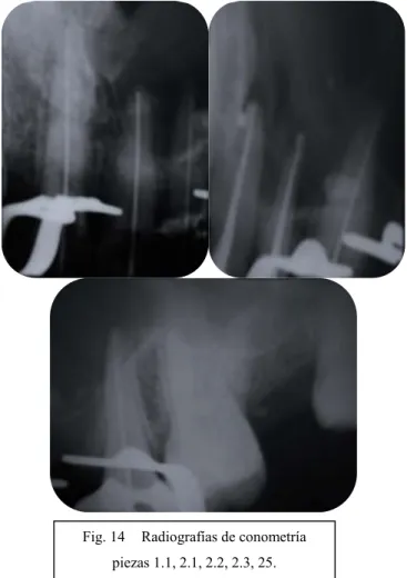 Fig. 14  Radiografías de conometría  piezas 1.1, 2.1, 2.2, 2.3, 25. 