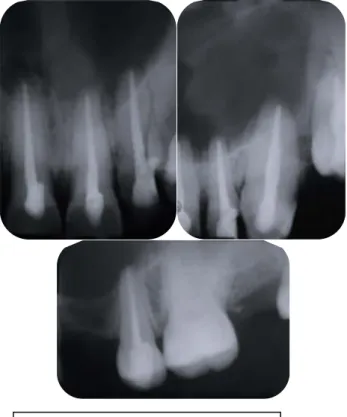 Fig. 18  Radiografía de control a los 7 días 