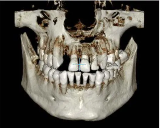 Fig. 21  Radiografía panorámica, control a los 5 años. 