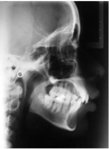 Fig. 11. Radiografía cefalométrica lateral inicial. 