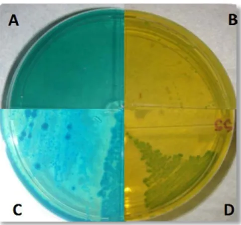 Figura 2. Medio selectivo para la cepa L. acidophilus. Figura 2-A. Medio sin siembra, Figura 2-B