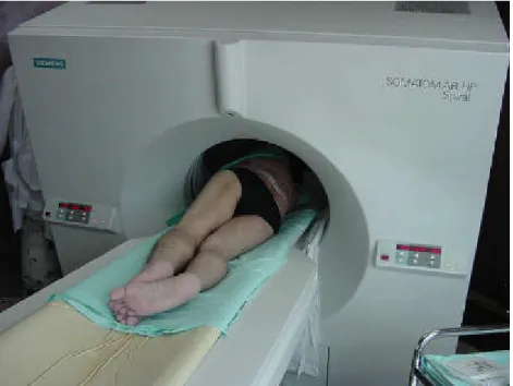 FIGURA 3: Paciente ubicado dentro del Gantry , en posición prona, previo a la  realización del procedimiento