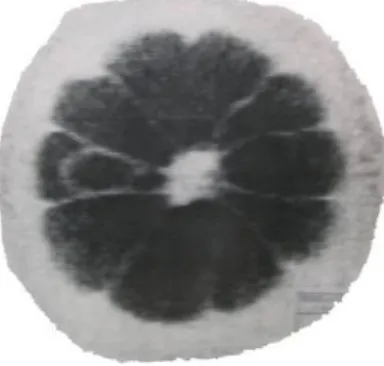 Figura 9 9 9 9. Primera imagen RMI realizada en limón (Hinshaw, 1977). 