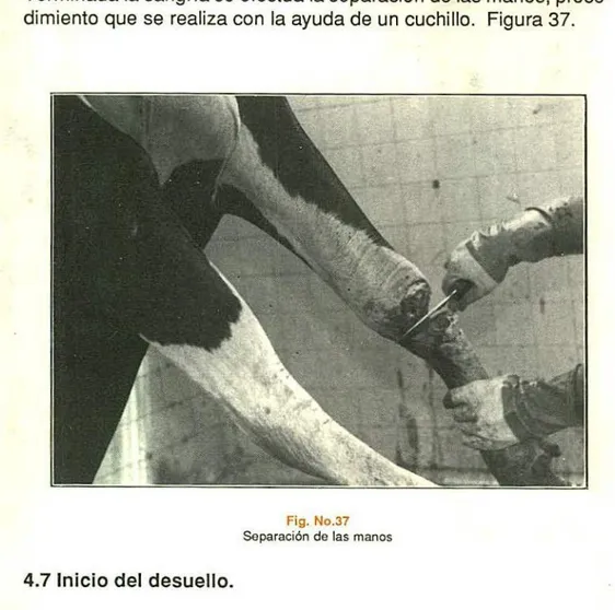 Fig. No.37 Separación de las manos