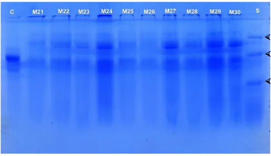 Figura  03:  Muestras  analizadas  en  SDS-PAGE  al  12%,  C:  control  de  Inmunoglobulina  G  con  un  peso  molecular  aproximado  de  50KD  indica  la  presencia de Ig G., M21 – M30 muestras de leche materna, S: estándar de pesos  moleculares de amplio
