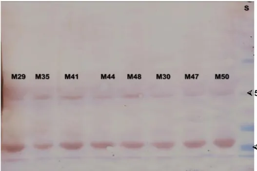 Figura  06:  Muestras  analizadas  por  western  blot.  De  diferentes  muestras  de  leche materna, mostrando dos bandas una de aproximadamente 50 kD (cadena  pesada) y una de aproximadamente 25 kD (cadena ligera ) 