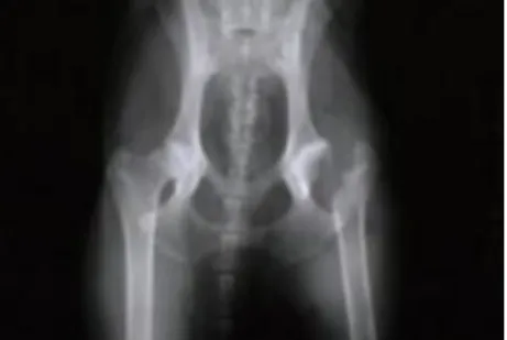 Figure 6. Normal hip (left) and arthritic hip  (arrow). Total hip replacement can restore  normal structure and function of ―ball and  socket‖ joint with implants (color picture)