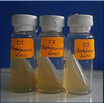 Figura 3: Cepas de Staphylococcus aureus 