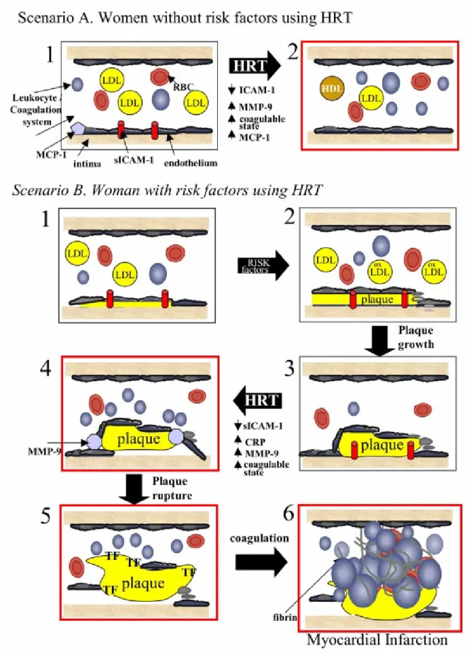 Figure 3. Role of hormone replacement therapy (HRT) in atherogenesis in women with and without cardiovascular risk factors.