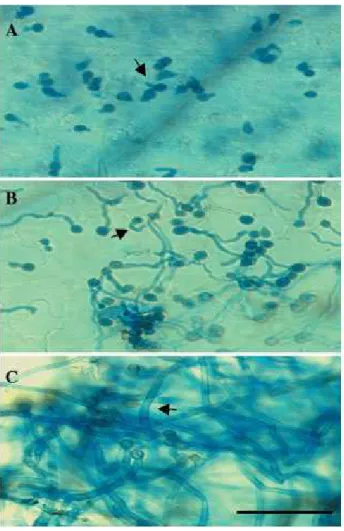 Figure 2: Temporal  analysis of the fungal  structures upon 
