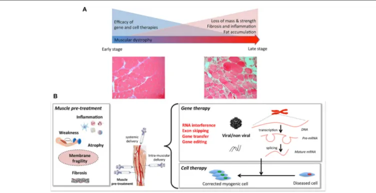 FIGURE 1 | (A) Muscular dystrophies fibers, including loss of mass, weakness, fat, and extracellular matrix accumulation