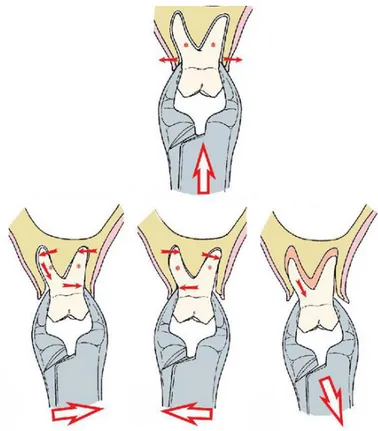Fig 1. Movimientos a realizar en extracciones de molares superiores  permanentes. 2 
