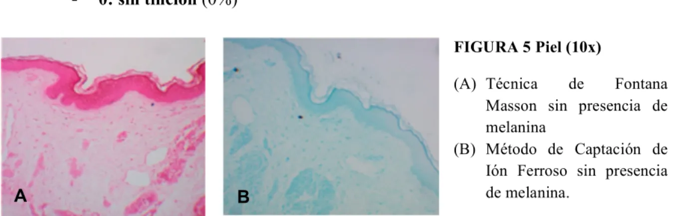 FIGURA 5 Piel (10x) 