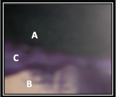 Figura	
  12	
  Corte	
  Transversal	
  observado	
   al	
   microscopio	
   óptico,	
   correspondiente	
   al	
   Grupos	
   Nº1.	
   A)	
   Restauración	
   en	
   Amalgama.	
   B)	
   Restauración	
   	
   en	
   Resina	
   Compuesta.	
  C)	
  Interfas