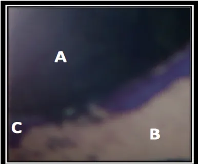 Figura	
  14	
  	
  Corte	
  Transversal	
  observado	
   al	
   microscopio	
   óptico,	
   correspondiente	
   al	
   Grupo	
   Nº2.	
   A)	
   Restauración	
   en	
   Amalgama.	
   B)	
   Restauración	
   en	
   Resina	
   Compuesta.	
  C)	
  Interfase	