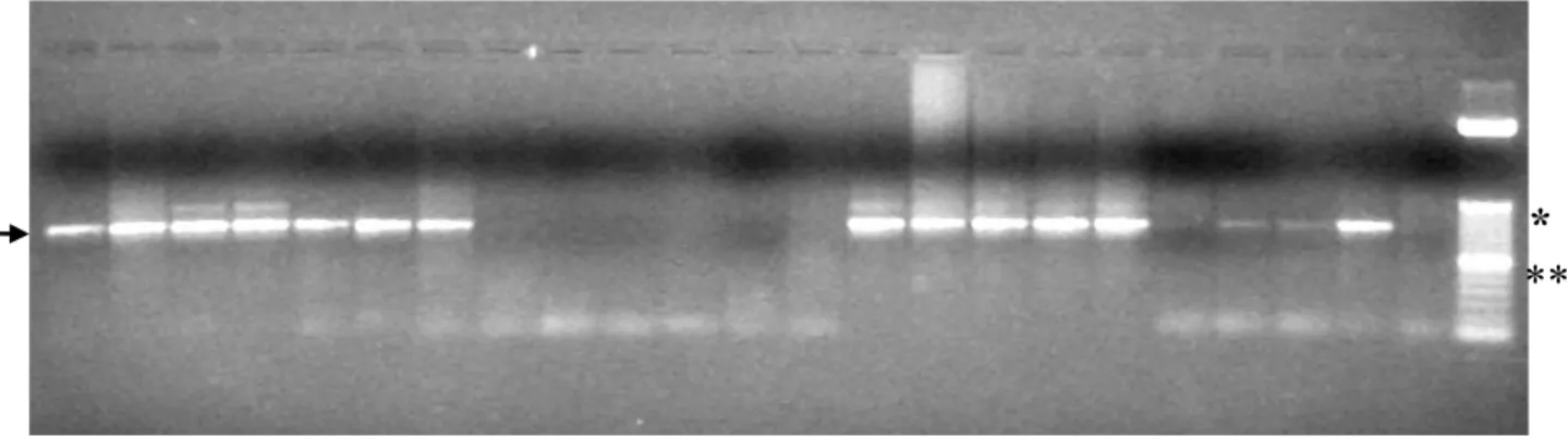 Figura  10.  Electroforesis  en  gel  de  agarosa  al  1.5%  con  muestras  de  camarones  individuales  analizados  por  PCR  para  la  detección  de  WSSV  por  el  protocolo  de  CENAIM con iniciadores de Kimura et al