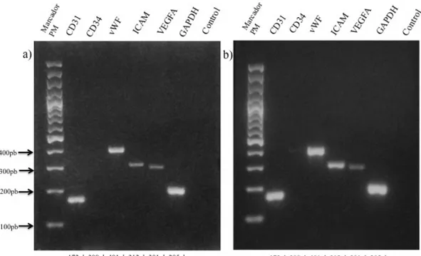 Figura 5. Caracterización de HUVECs mediante RT-PCR.