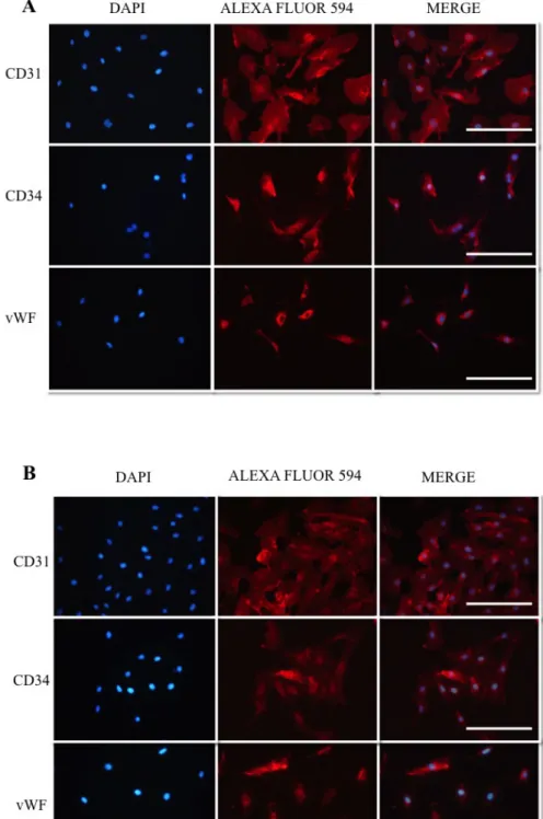 Figura 7. Caracterización de HUVECs mediante Inmunofluorescencia.