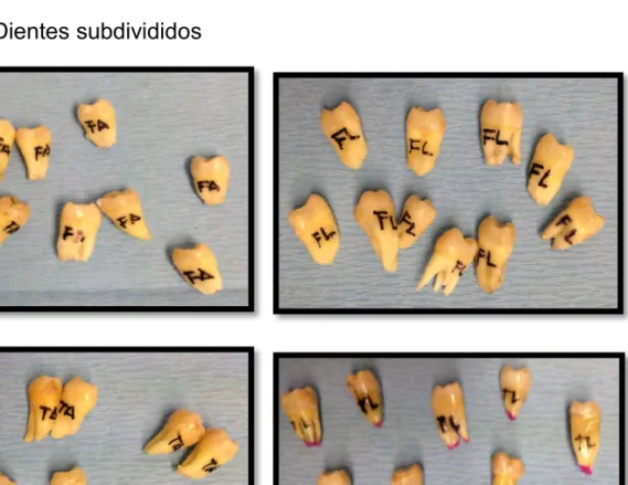 Figura 10. Dientes subdivididos 