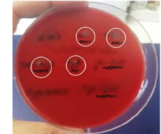 Figure  8.Determination  of  hemolysis  induced  by  polysaccharides-based  silver  nanoparticles  (Ag@BSA1  and  Ag@RSC1)  on  blood  agar  plate