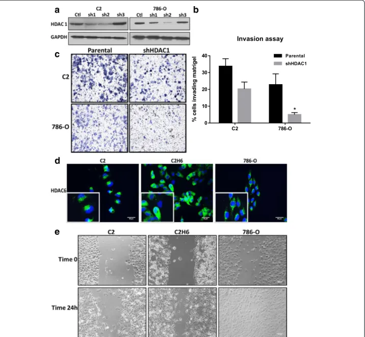 Figure S2a). This constitutive expression of HIF-α was associated with higher HDAC 1 expression in C2 cells