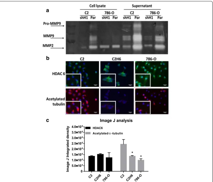 Fig. 3 HDAC 1 and HDAC 6 increase MMP-2/9 activity and decrease acetylated α-tubulin levels, respectively