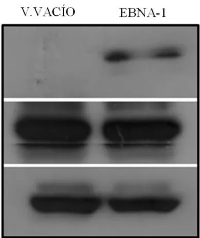 Figura 7. Detección de EBNA-1 en células AGS transducidas con vector retroviral. Western  blot  realizado  en  extractos  de  proteína  obtenidos  de  células  AGS  transducidas  con  vector  de  expresión  retroviral  EBNA-1  y  células  AGS  transducidas