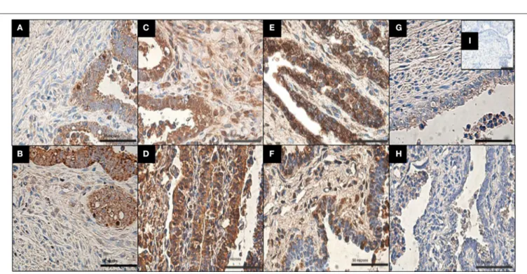 FIGURE 2 | Immunolocalization of MMP-9, MMP-3, MMP-8, and TIMP-1 in infected and uninfected explants