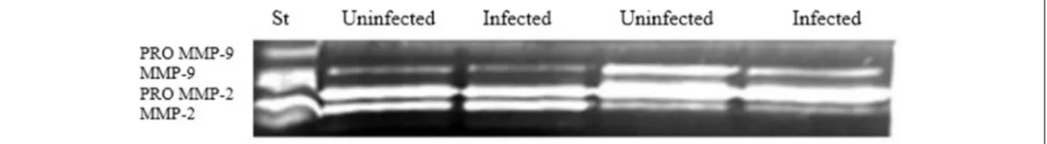 FIGURE 4 | MMP-9 gelatinase activity. Supernatants from control and infected explants were analyzed by gelatin zymography to evaluate MMP-9 activity (n = 7)