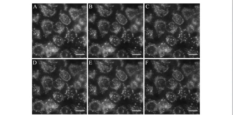 FIGURE 6 | B2 exhibits resistance to photobleaching. HeLa cells were stained with 50 µg/mL B2 for 30 min at 37 ◦ C and observed under the fluorescent microscope immediately (A), or 5 min (B), 10 min (C), 15 min (D), 30 min (E), 60 min (F) after the stainin