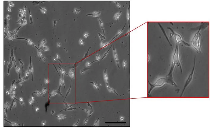 Figura 3: Cultivo primario de 48 hr de cardiomiocitos de ratas neonatas.  Se muestra una fotografía en campo  claro en la cual destaca la morfología típica de estas células: de forma alargada y estrellada, con un núcleo central y  prolongaciones celulares 