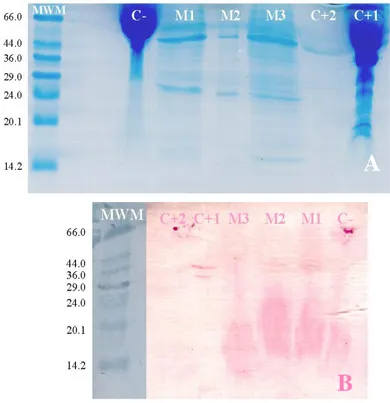 Figura 8.  A. Gel desnaturalizante de poliacrilamida (SDS-PAGE) teñido con  azul de Coomasie