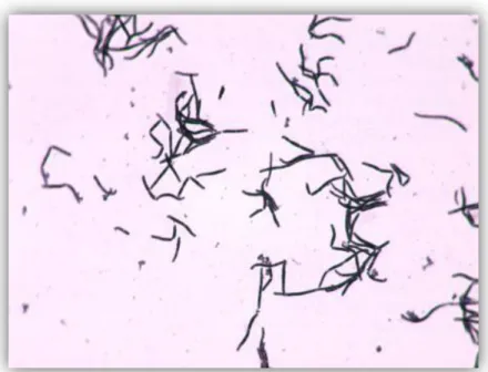 Figura 4. Lactobacillus bulgaricus observados a 100x. 