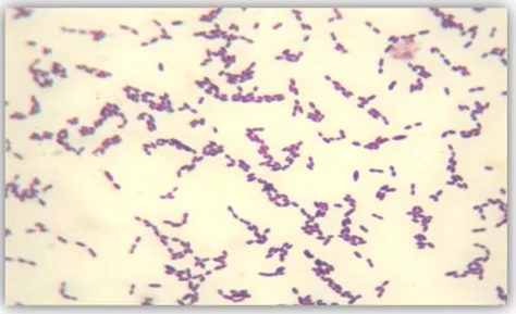 Figura 5. Streptococcus thermophilus observados a más de 100x. 