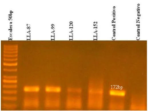 Figura 3. Gel de agarosa con productos de PCR para el polimorfismo L55M      