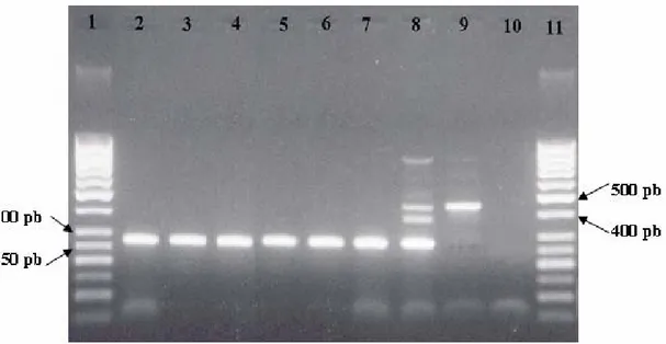 Figura 2. Identificación molecular de nematodos de quiste de papa de Costa Rica. Reacción múltiple  utilizando los imprimadores específicos PITSr3 y PITSp4 y el imprimador universal ITS5