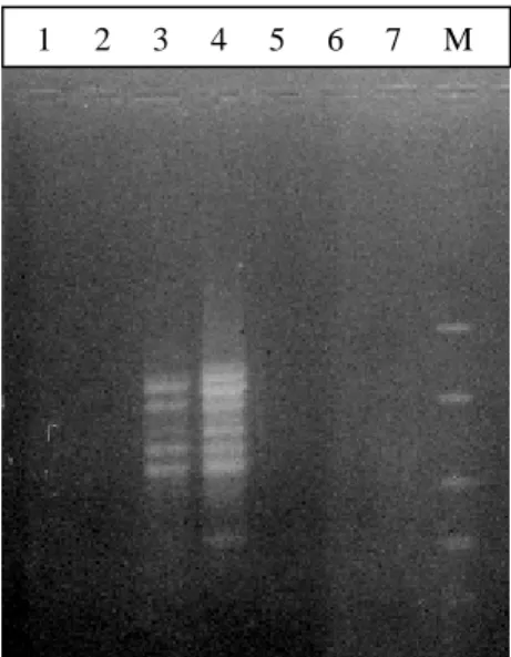 Figura 8. Electroforesis en gel de agarosa al 1,5% a 80 voltios por 1 hora y 30 minutos de los productos de la  RAPD-PCR con el OPA02 de muestras de ADN extraídas con el kit Wizard® (1y 2) 1/10, 1/50 PB NL          (3 y 4) 1/10, 1/50 CV (5 y 6) 1/10, 1/50 