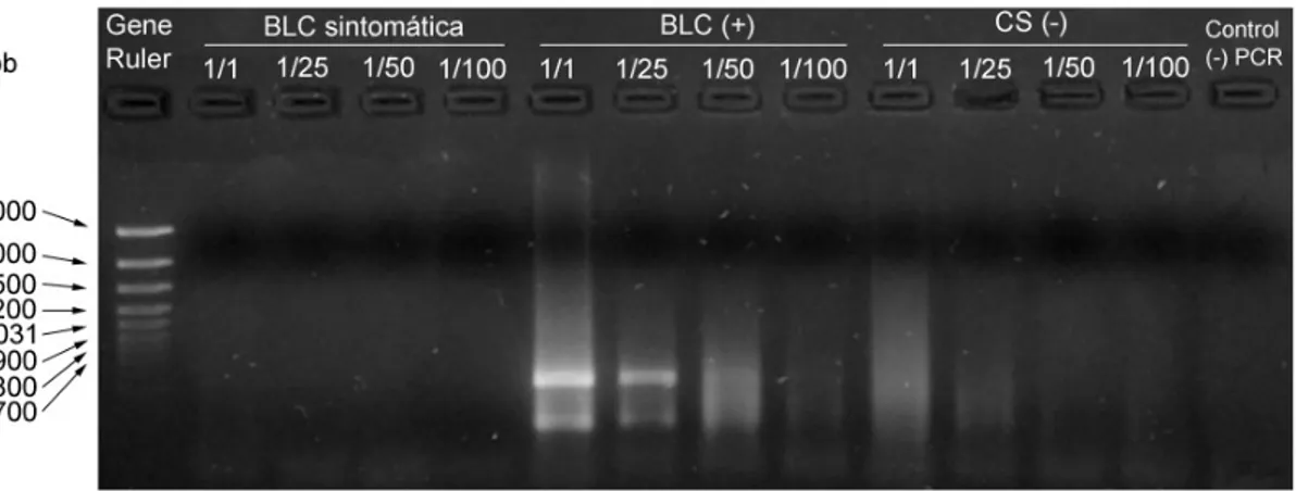 Figura 5.1   Análisis mediante electroforesis en gel de agarosa al 1,5% de los fragmentos de ADN viral  amplificado mediante TD/RT-PCR con 100 U de Transcriptasa Reversa, aplicado a diferentes diluciones de  ácidos nucleicos totales para tres muestras de o
