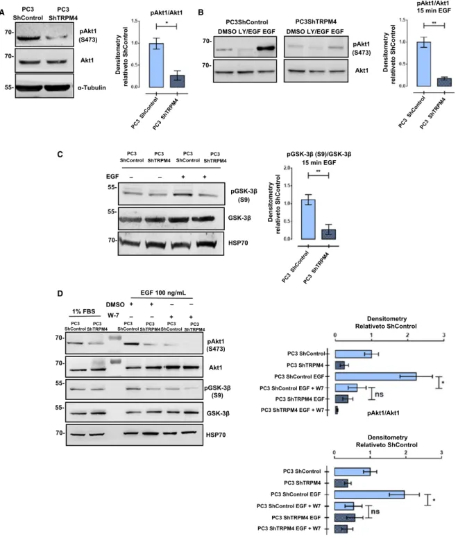 Fig. 7. TRPM4 regulates the normal activation of Akt1 in PC3 cells. (A) PC3 ShControl shows an increased phosphorylation of Ser473 on AKT1 compared to PC3 ShTRPM4 under basal (nonstimulated) conditions
