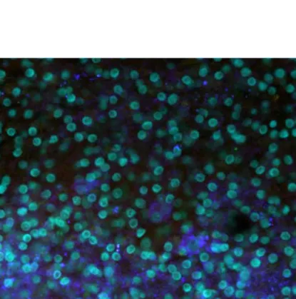 Figura 4: Neuronas dopaminérgicas en cultivos organotípicos 