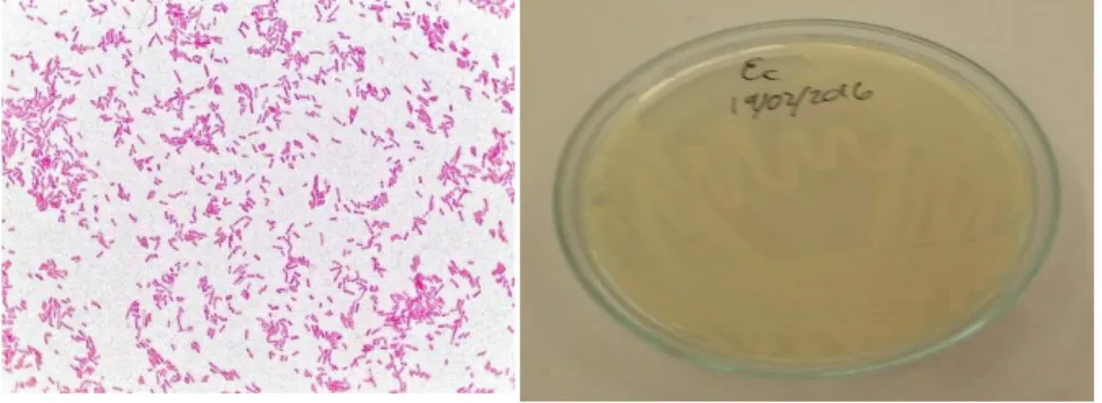 Foto n°02 Características Macroscópicas de  E.coli