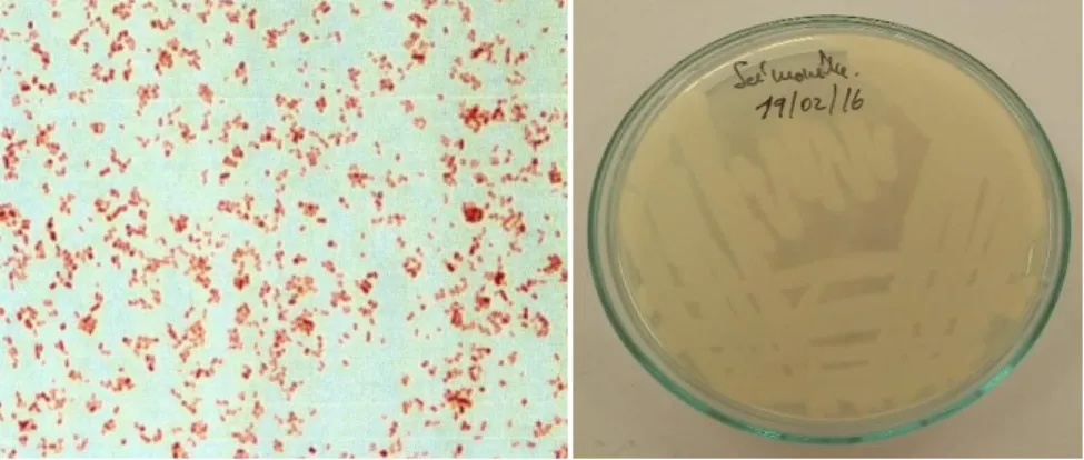 Foto n°04.Características  Macroscópicas de salmonella typhi..