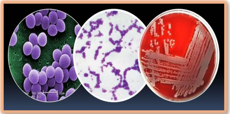 FIGURA N° 7: Staphylococcus aureus  Fuente: Google_images  (13)